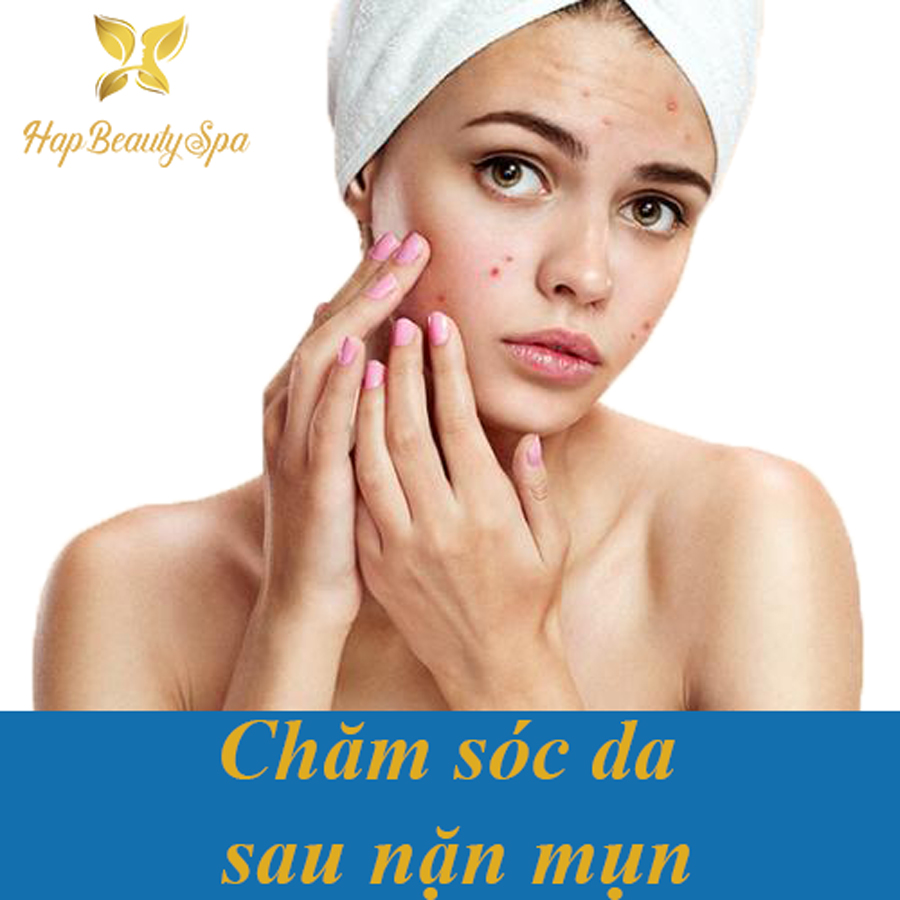 Tại Sao Bạn Nên Chú ý Chăm Sóc Da Sau Khi Nặn Mụn đúng Cách 